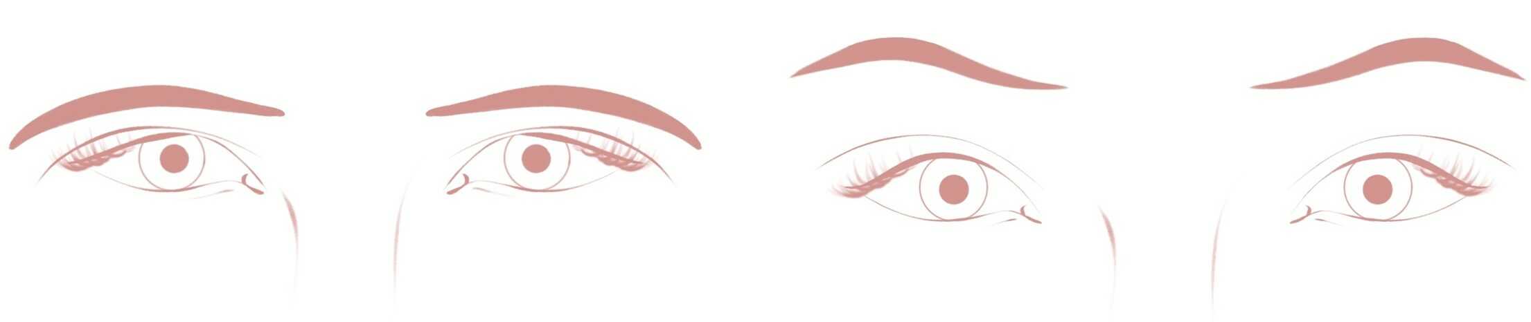 Vorher und Nachher eines operativen Augenbrauenliftings.